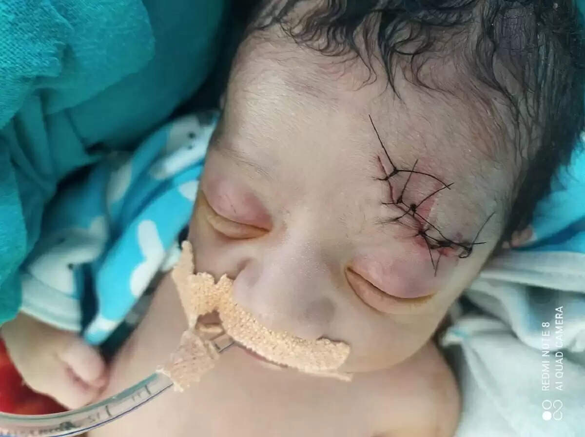 टांडा में नवजात की मौत का मामलाः मां की जान बचाने को किया औजारों का प्रयोग
